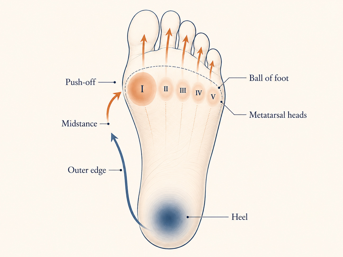 Diagram of the five metatarsal bones showing the sequential pressure distribution from heel strike through push-off with the first metatarsal head bearing the largest load